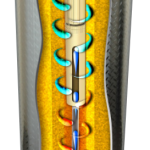 Complete Home Filtration